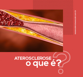 Aterosclerose: O que é?